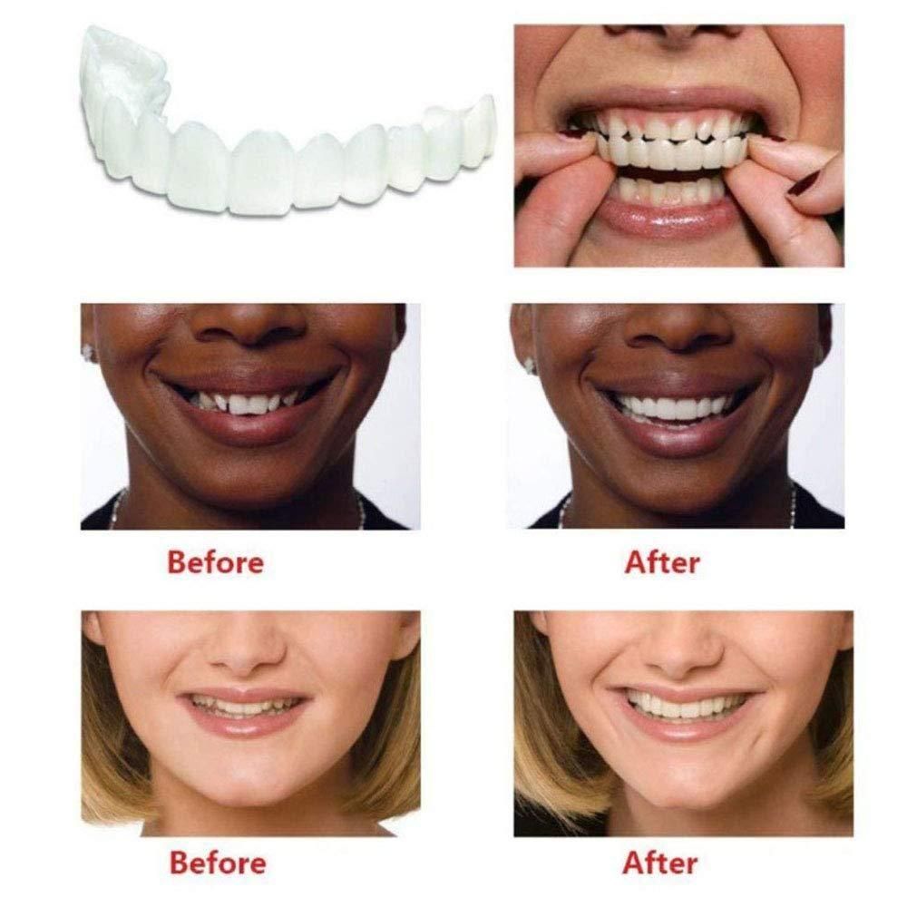 Instant Smile Cosmetic Teeth Veneer – Pack of 1